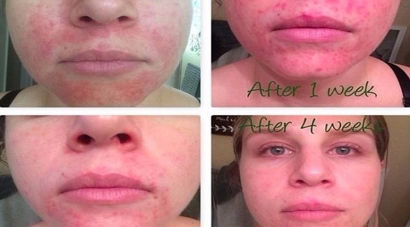 صورة المقالة