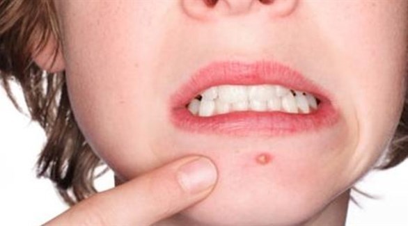 صورة المقالة