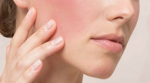 صورة المقالة