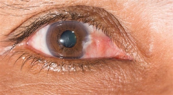 صورة المقالة