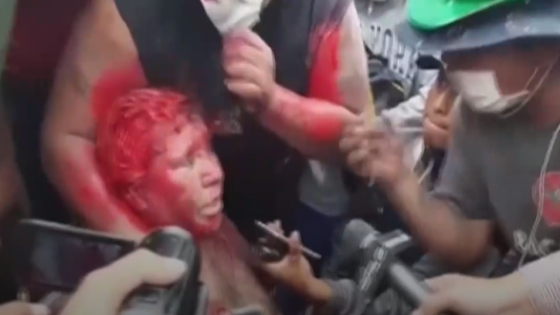 الإعتداء على عمدة مدينة فينتو البوليفية وحلق شعرها و صبغ جلدها