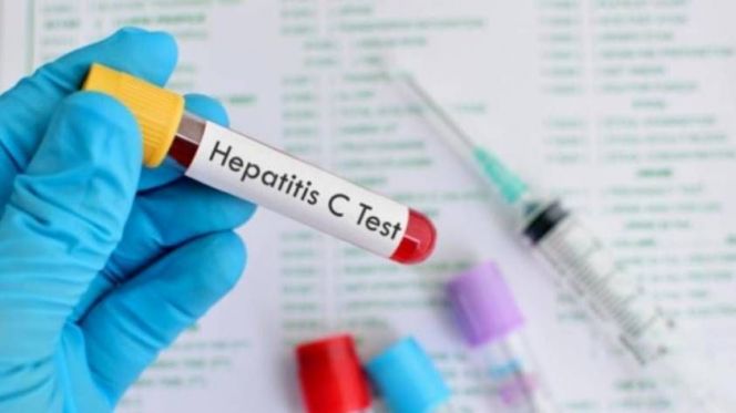 صورة المقالة