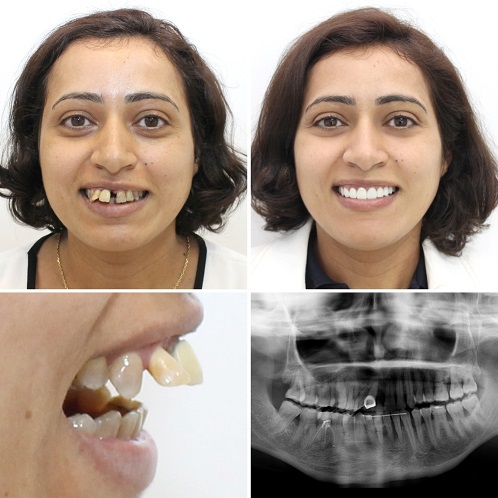 صورة المقالة