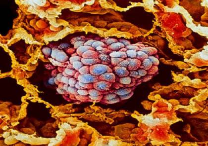 صورة المقالة