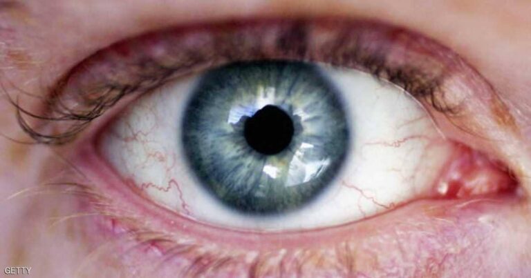 صورة المقالة