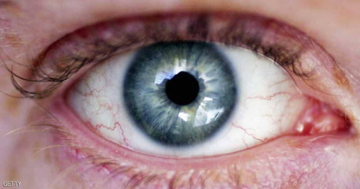 بشرى سارة للمصابين بالعمى