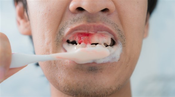 صورة المقالة