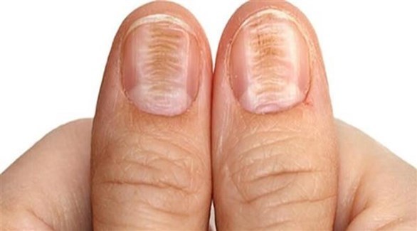 صورة المقالة