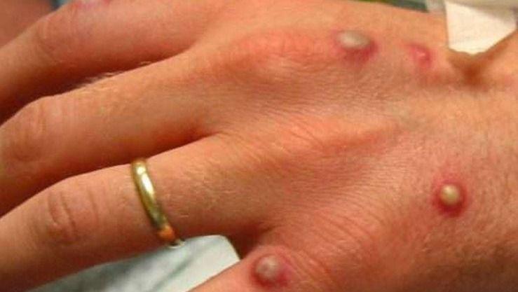 صورة المقالة