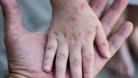 صورة المقالة