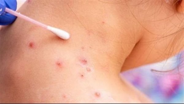 صورة المقالة