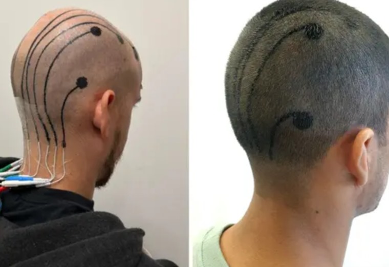 صورة المقالة