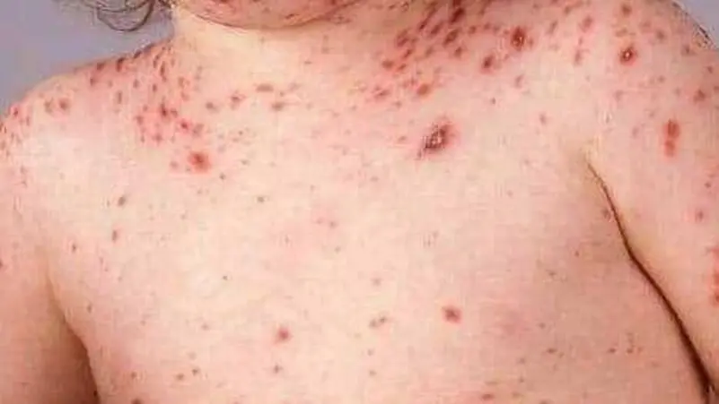 صورة المقالة