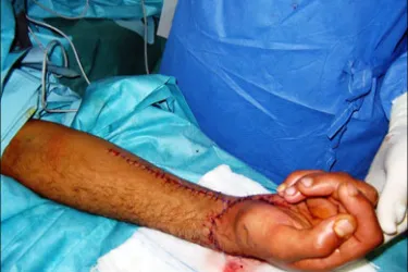 صورة المقالة