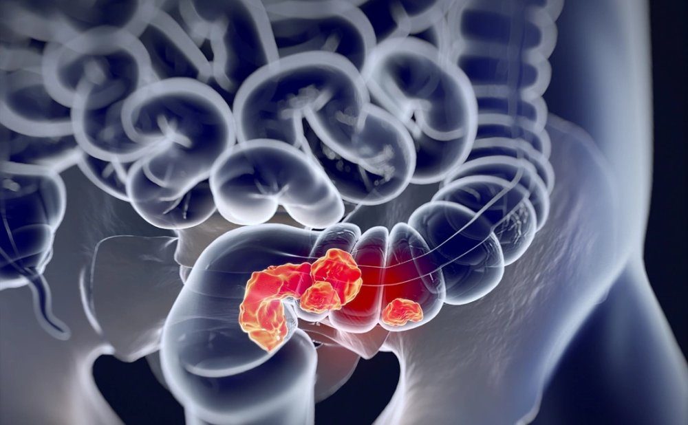 صورة المقالة